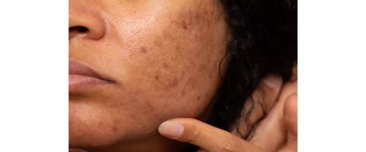 Facial Lelaki di Rumah: Cara Mudah & Murah
