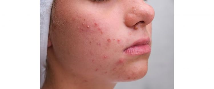 Tip Pakai Mascara Supaya Tidak Berbekas Bawah Mata