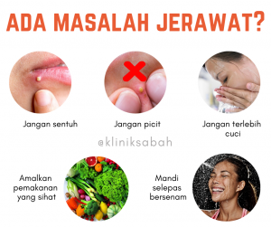 Cara Kawal Gula Untuk Elakkan Jerawat