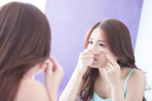 Cara Mencegah Whiteheads Daripada Muncul Kembali