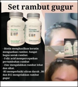 Masalah Rambut Gugur: Adakah Disebabkan Diet?